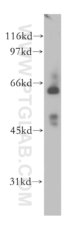 Western Blot (WB) analysis of HEK-293 cells using PHD1 Polyclonal antibody (12984-1-AP)