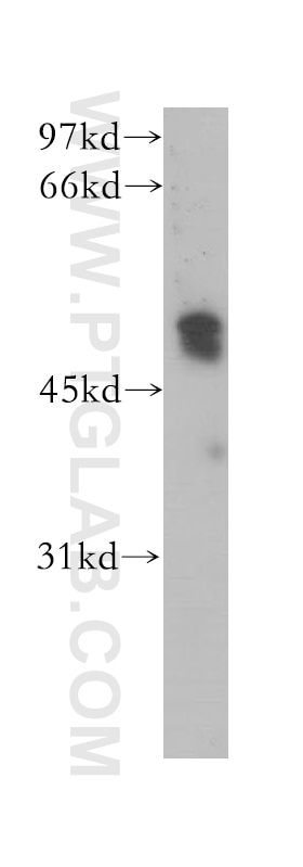 Western Blot (WB) analysis of human spleen tissue using PHD1 Polyclonal antibody (12984-1-AP)