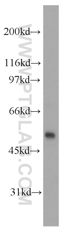 Western Blot (WB) analysis of PC-3 cells using PHD1 Polyclonal antibody (12984-1-AP)