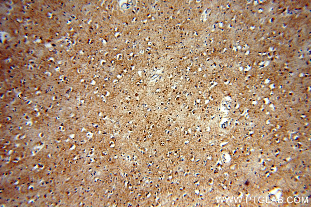 IHC staining of human brain using 18325-1-AP