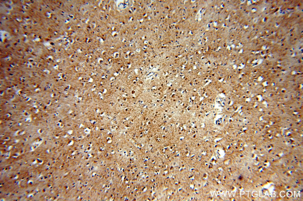 Immunohistochemistry (IHC) staining of human brain tissue using PHD3 Polyclonal antibody (18325-1-AP)