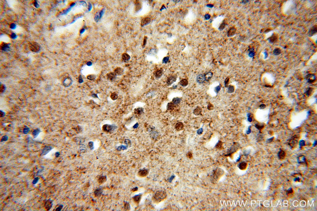Immunohistochemistry (IHC) staining of human brain tissue using PHD3 Polyclonal antibody (18325-1-AP)