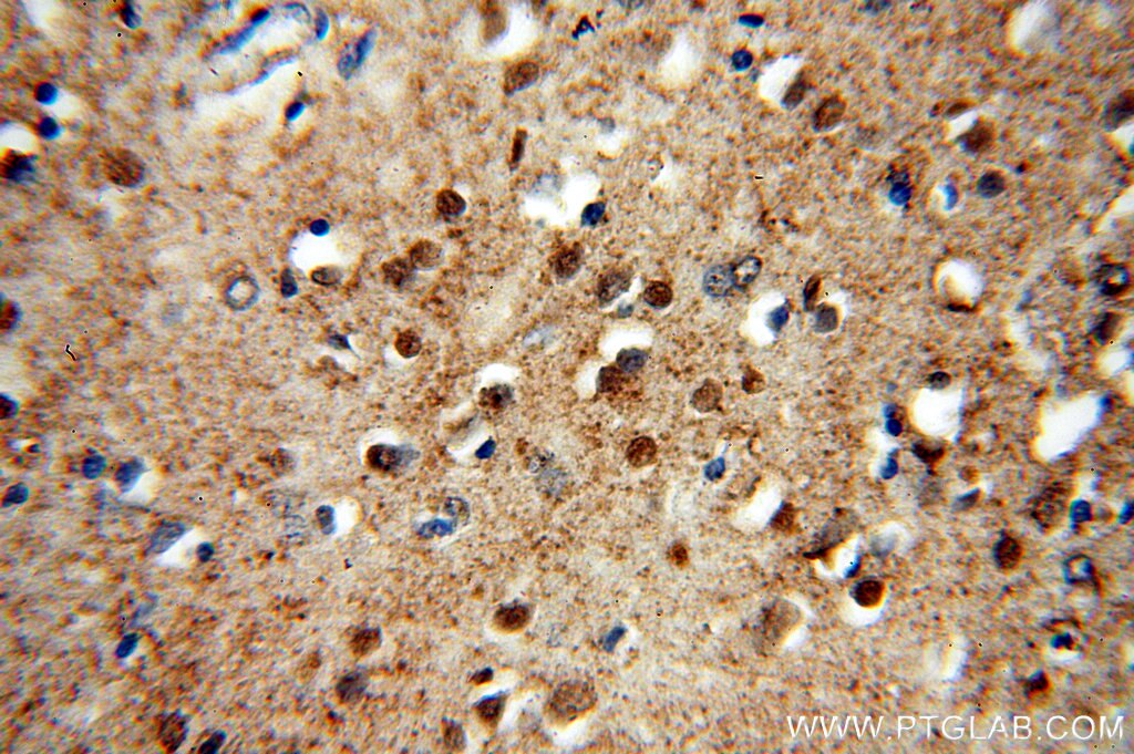 IHC staining of human brain using 18325-1-AP