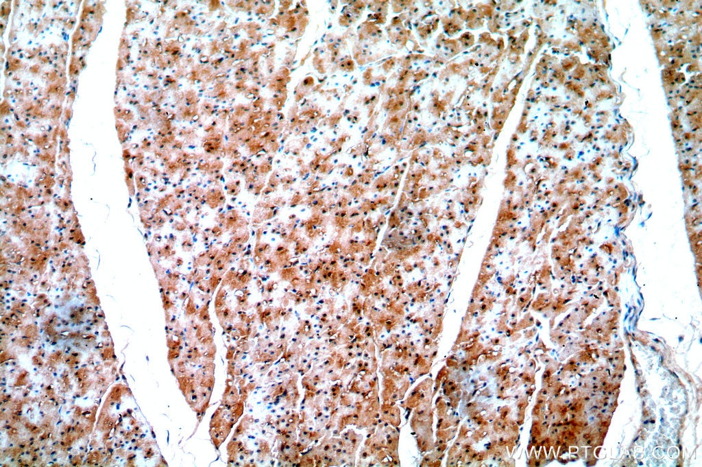 Immunohistochemistry (IHC) staining of human heart tissue using EGLN3/PHD3 Polyclonal antibody (18325-1-AP)