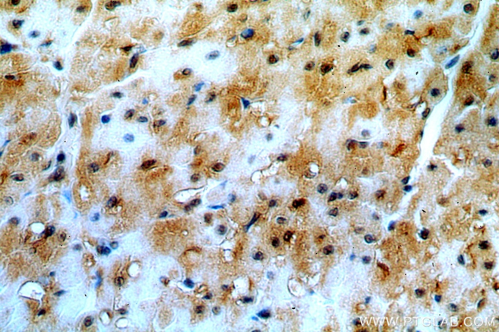 Immunohistochemistry (IHC) staining of human heart tissue using PHD3 Polyclonal antibody (18325-1-AP)