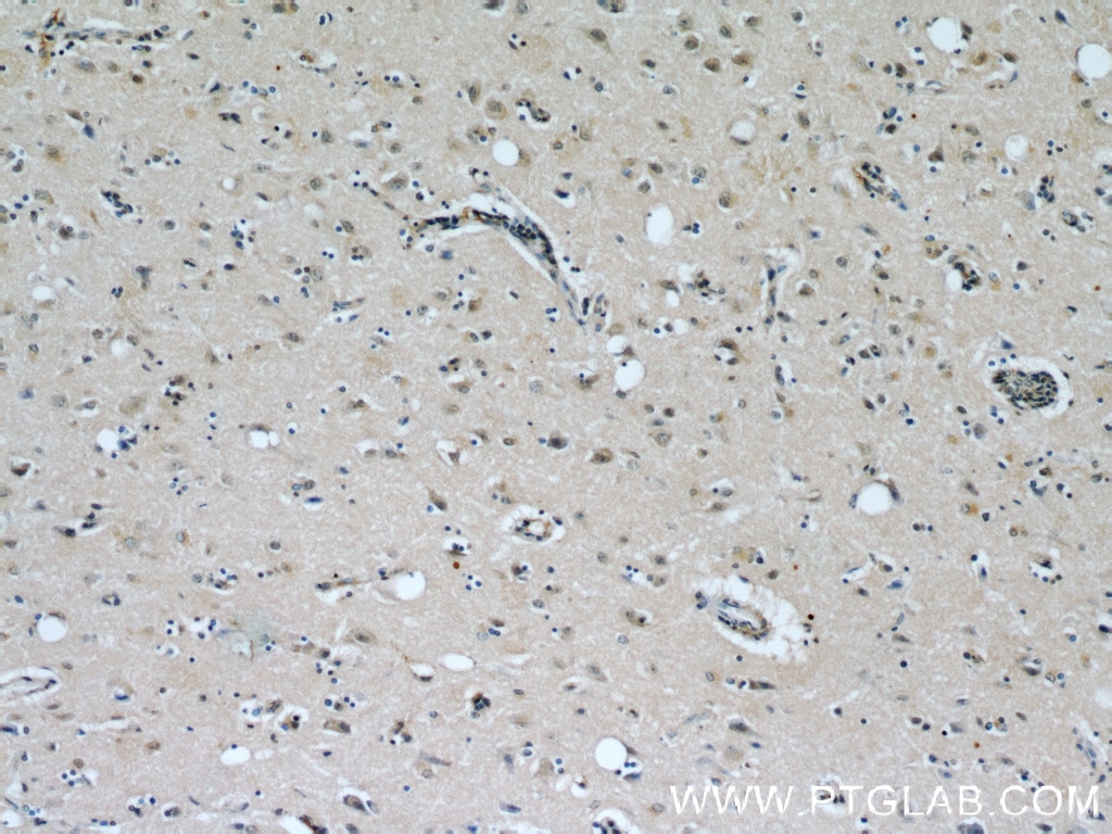 Immunohistochemistry (IHC) staining of human brain tissue using PHD3 Polyclonal antibody (18325-1-AP)