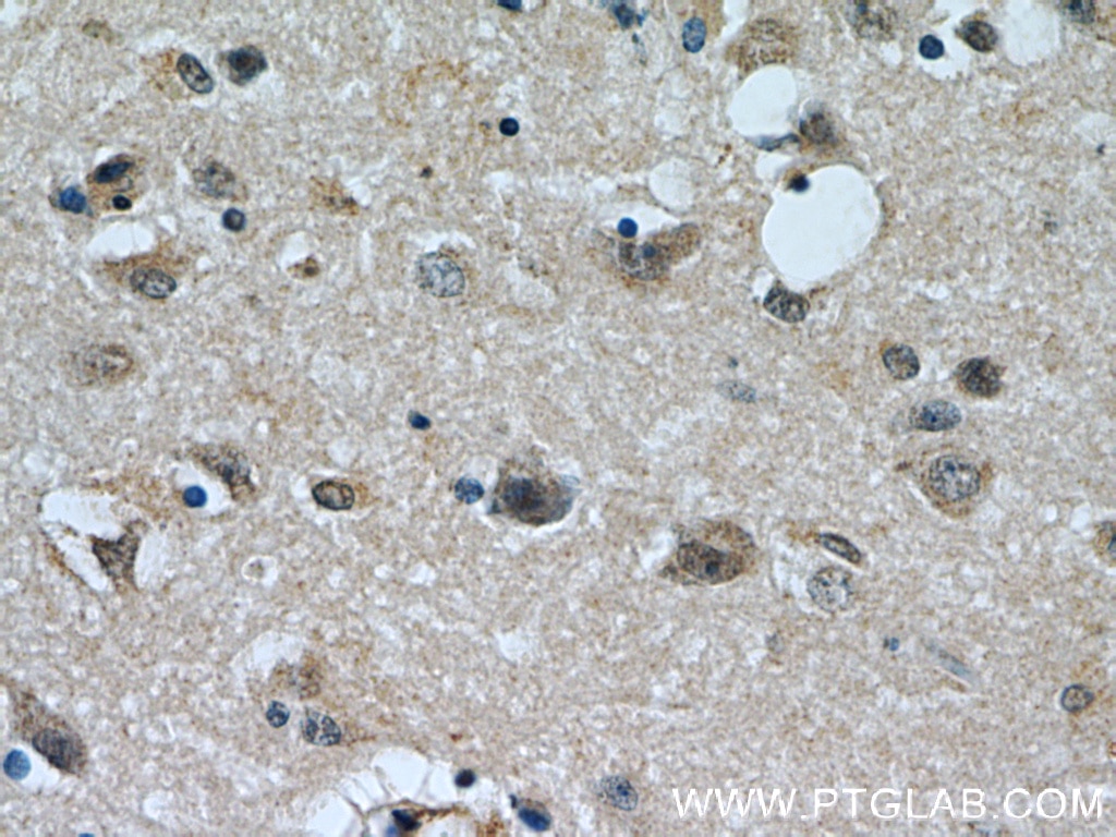 Immunohistochemistry (IHC) staining of human brain tissue using PHD3 Polyclonal antibody (18325-1-AP)
