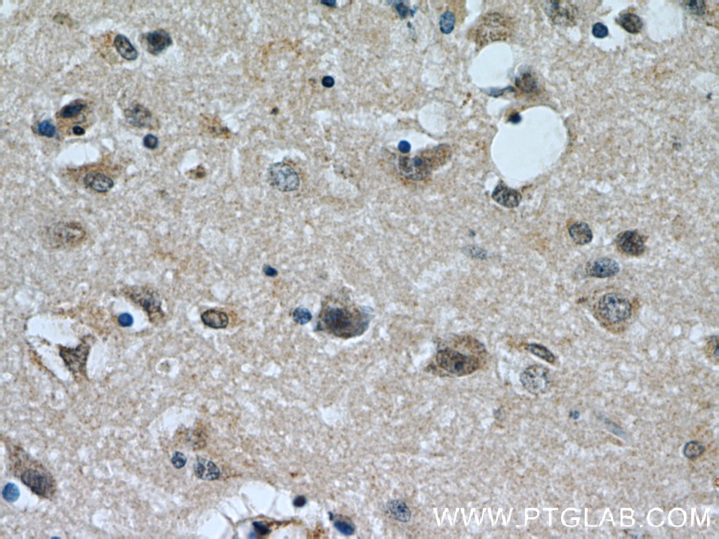 IHC staining of human brain using 18325-1-AP