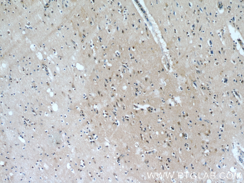 Immunohistochemistry (IHC) staining of human brain tissue using EGLN3/PHD3 Polyclonal antibody (18325-1-AP)