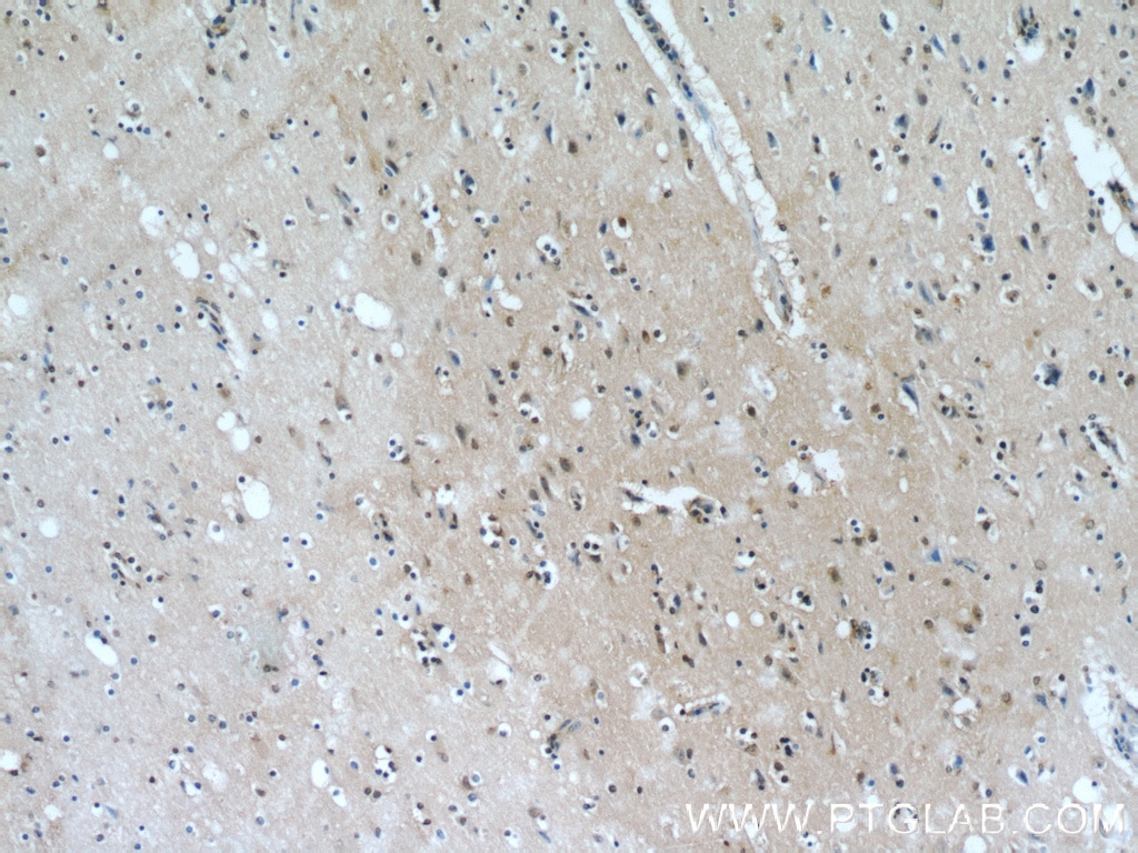 Immunohistochemistry (IHC) staining of human brain tissue using PHD3 Polyclonal antibody (18325-1-AP)