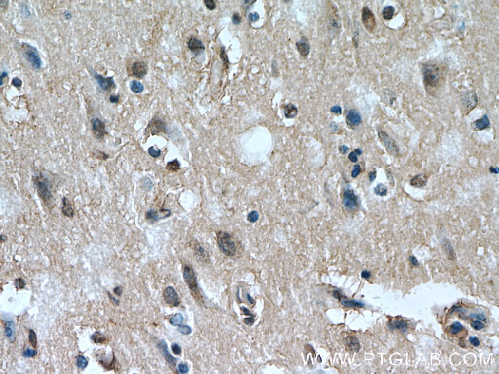 Immunohistochemistry (IHC) staining of human brain tissue using PHD3 Polyclonal antibody (18325-1-AP)