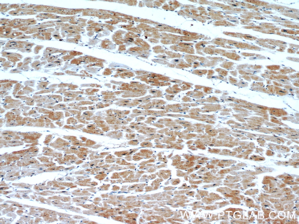 Immunohistochemistry (IHC) staining of human heart tissue using PHD3 Polyclonal antibody (18325-1-AP)