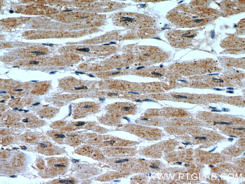 IHC staining of human heart using 18325-1-AP