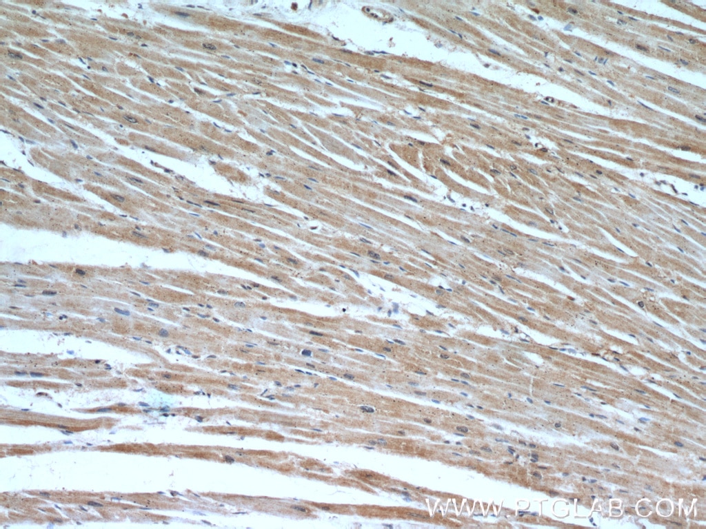 IHC staining of human heart using 18325-1-AP