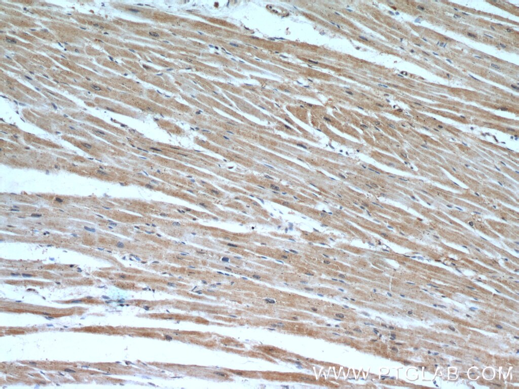 Immunohistochemistry (IHC) staining of human heart tissue using EGLN3/PHD3 Polyclonal antibody (18325-1-AP)