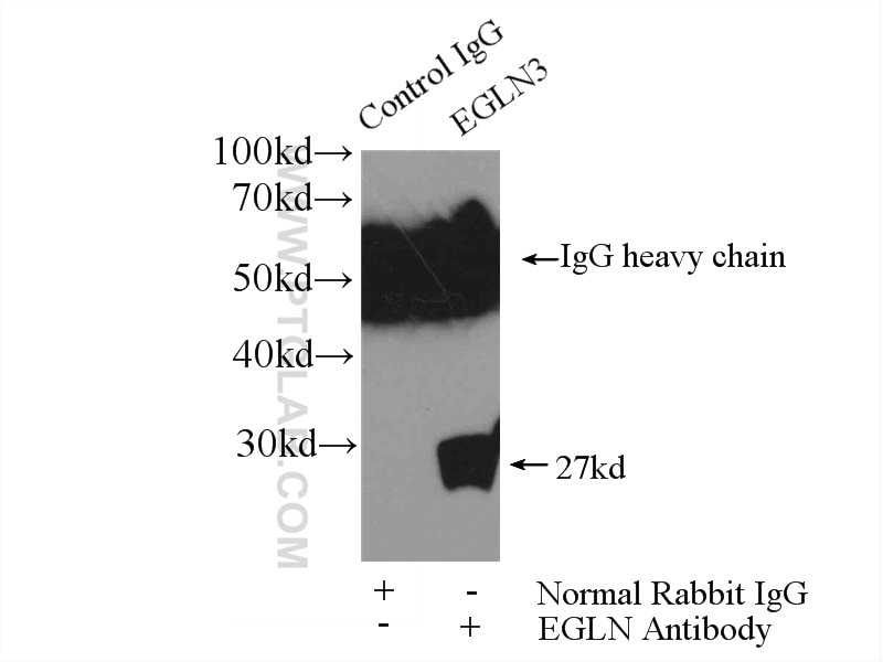 Immunoprecipitation (IP) experiment of A375 cells using EGLN3/PHD3 Polyclonal antibody (18325-1-AP)