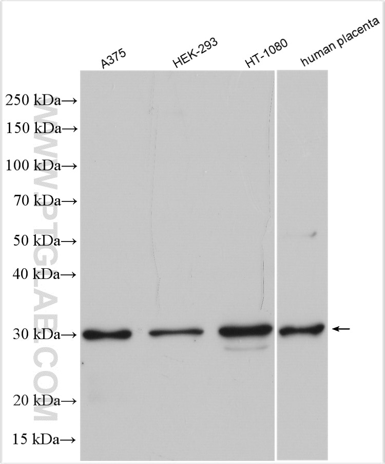 Western Blot (WB) analysis of various lysates using EGLN3/PHD3 Polyclonal antibody (18325-1-AP)