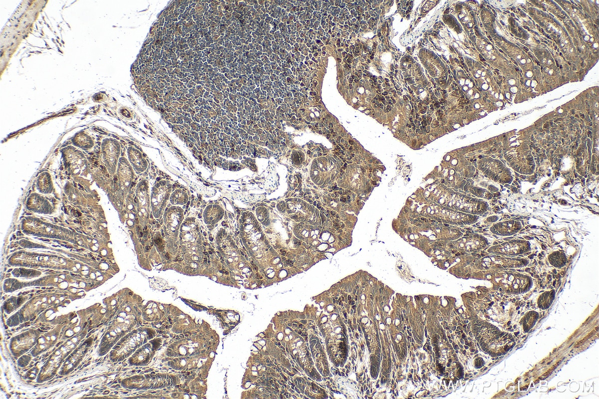 Immunohistochemistry (IHC) staining of mouse colon tissue using EGLN3/PHD3 Polyclonal antibody (27875-1-AP)