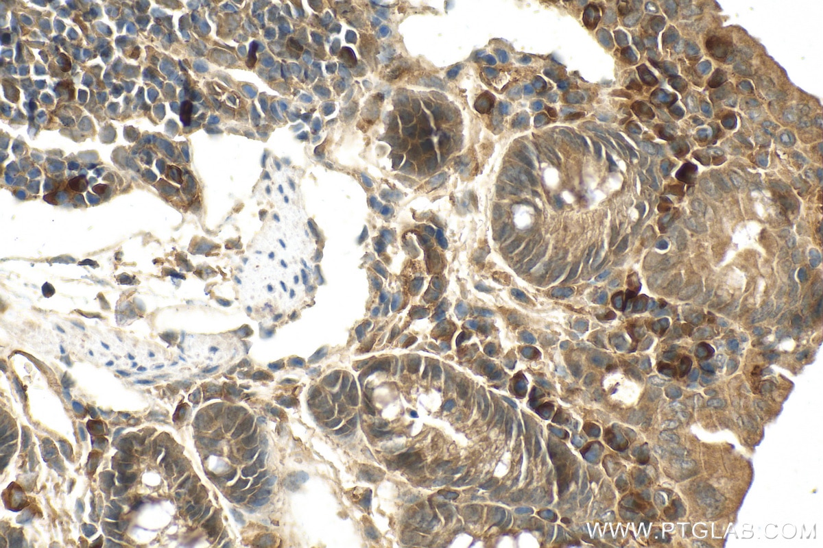 Immunohistochemistry (IHC) staining of mouse colon tissue using EGLN3/PHD3 Polyclonal antibody (27875-1-AP)