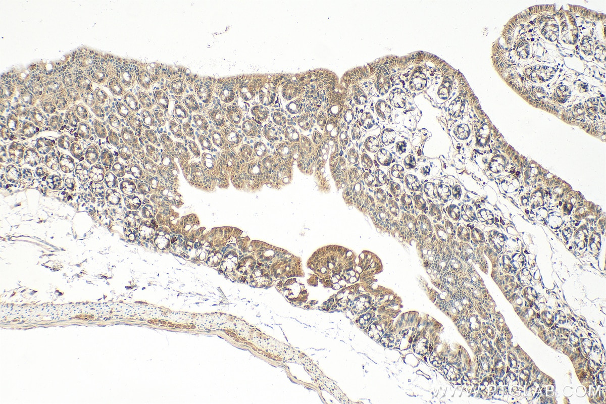 Immunohistochemistry (IHC) staining of mouse colon tissue using EGLN3/PHD3 Polyclonal antibody (27875-1-AP)