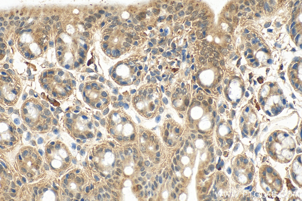 IHC staining of mouse colon using 27875-1-AP