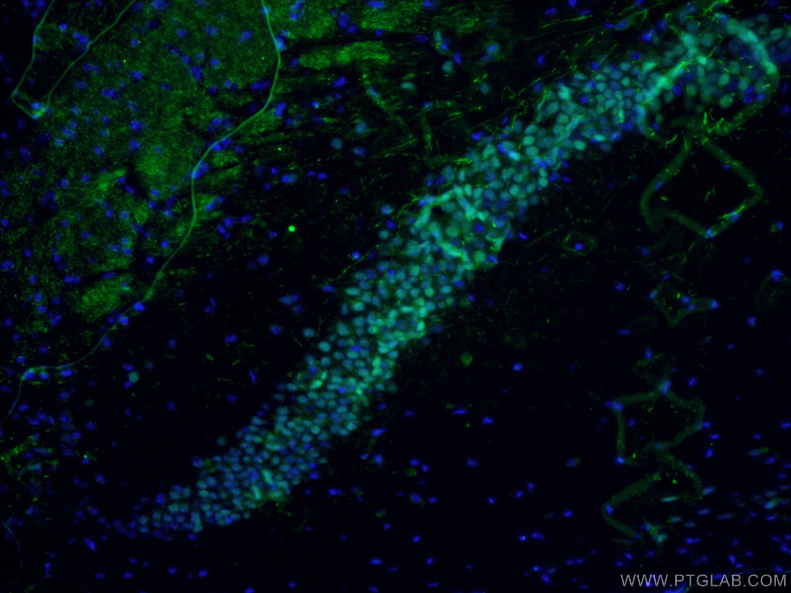 Immunofluorescence (IF) / fluorescent staining of mouse brain tissue using EGR1 Polyclonal antibody (22008-1-AP)