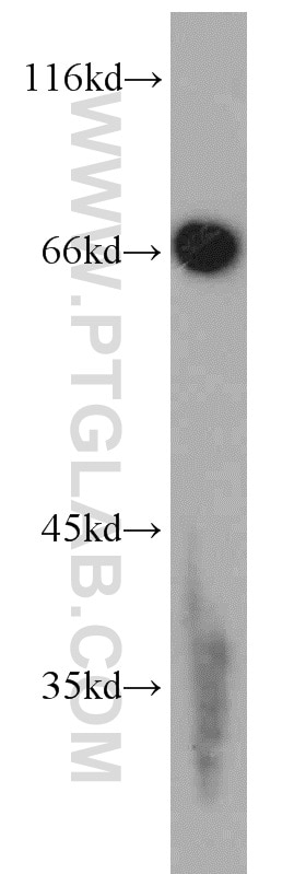 Western Blot (WB) analysis of RAW264.7 using EGR1 Polyclonal antibody (22008-1-AP)