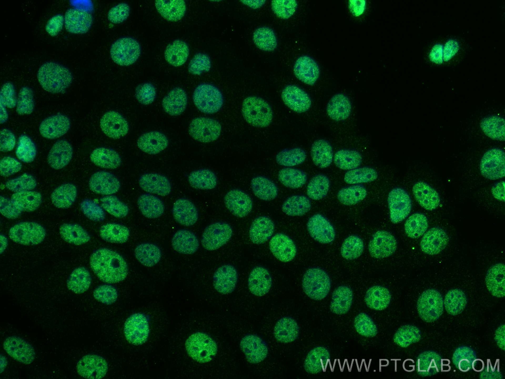 Immunofluorescence (IF) / fluorescent staining of MCF-7 cells using EGR1 Polyclonal antibody (55117-1-AP)