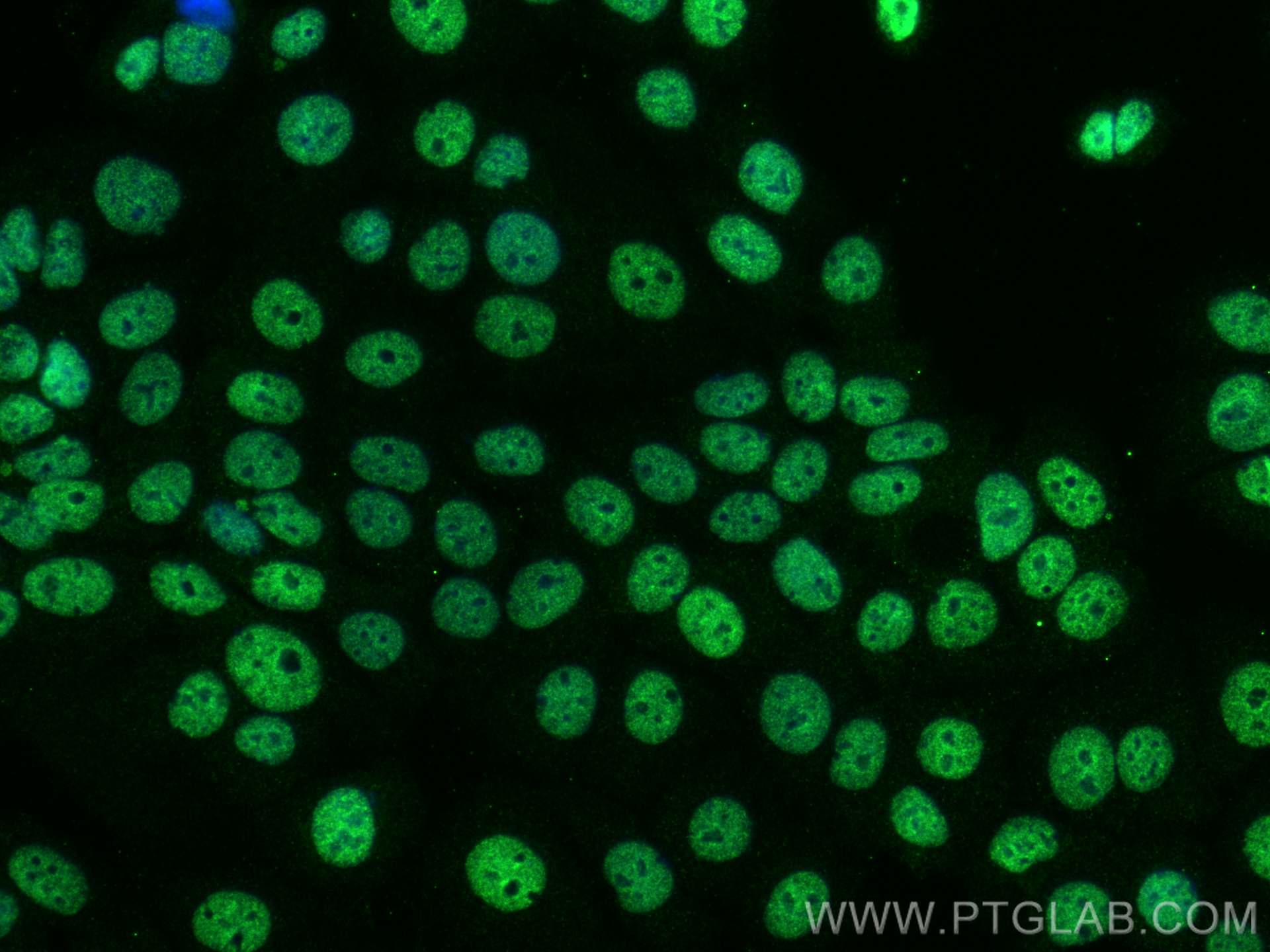 IF Staining of MCF-7 using 55117-1-AP