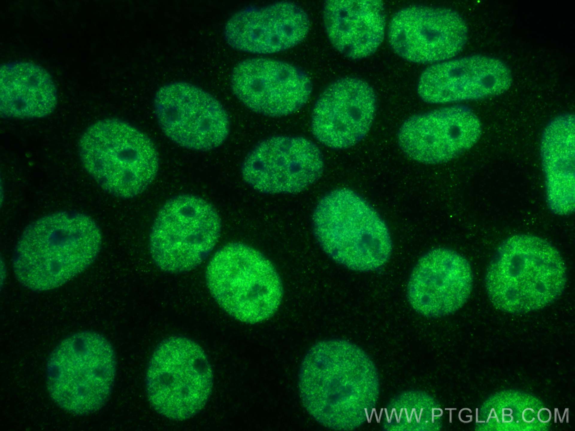 Immunofluorescence (IF) / fluorescent staining of MCF-7 cells using EGR1 Polyclonal antibody (55117-1-AP)