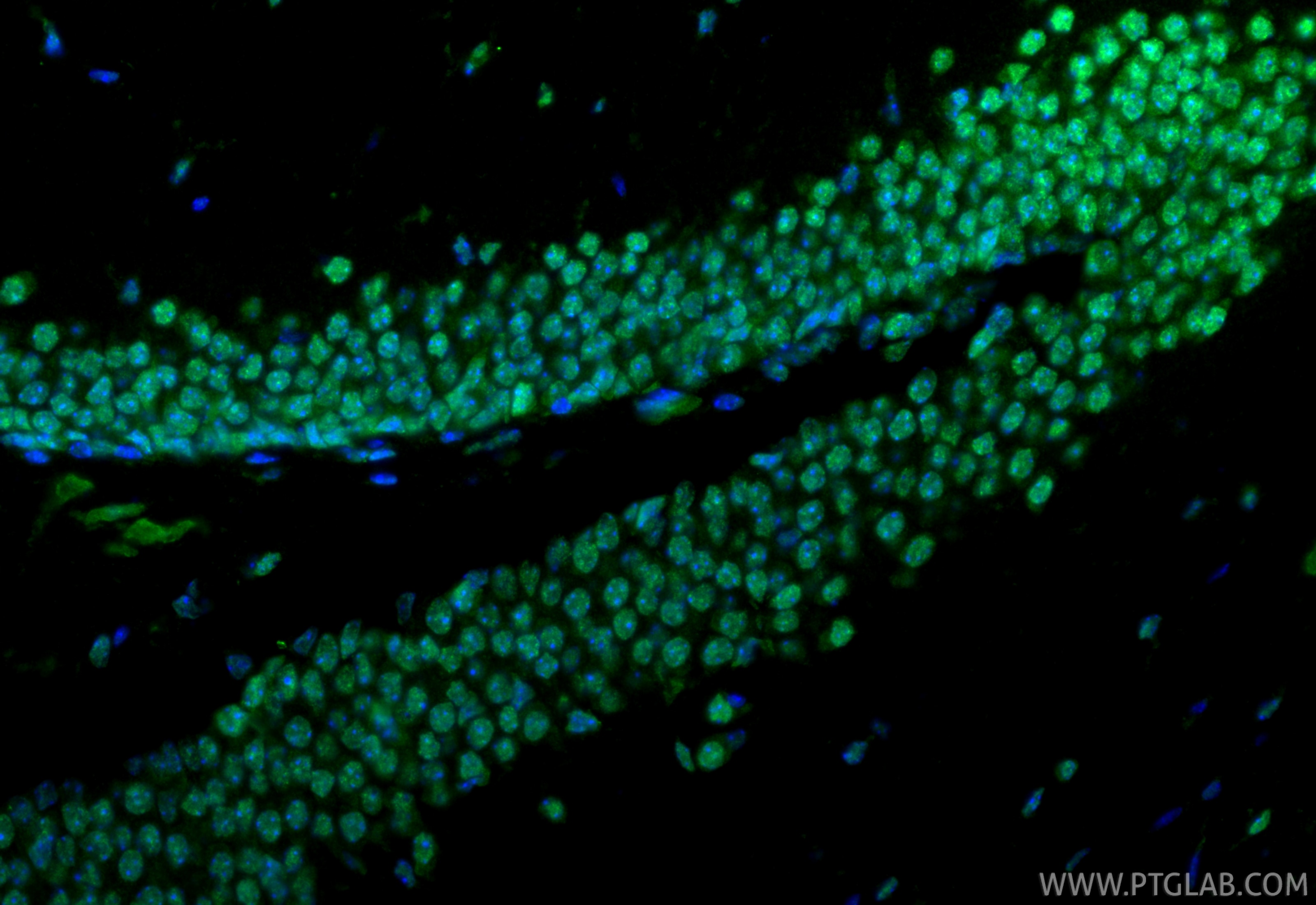 Immunofluorescence (IF) / fluorescent staining of mouse brain tissue using EGR1 Polyclonal antibody (55117-1-AP)