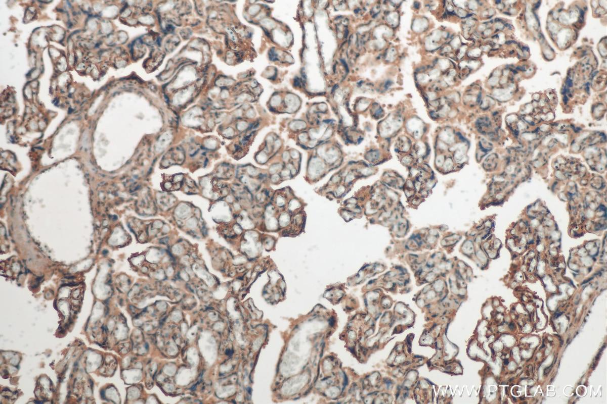 Immunohistochemistry (IHC) staining of human placenta tissue using EGR1 Polyclonal antibody (55117-1-AP)