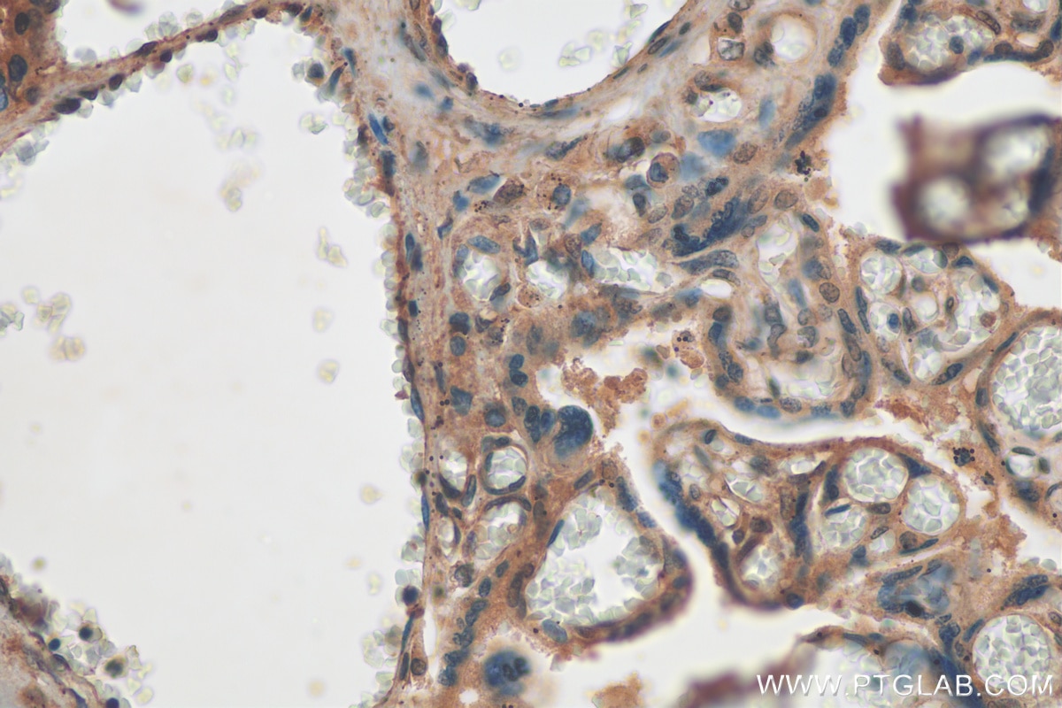 Immunohistochemistry (IHC) staining of human placenta tissue using EGR1 Polyclonal antibody (55117-1-AP)