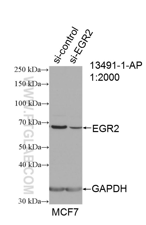 Western Blot (WB) analysis of MCF-7 cells using EGR2 Polyclonal antibody (13491-1-AP)