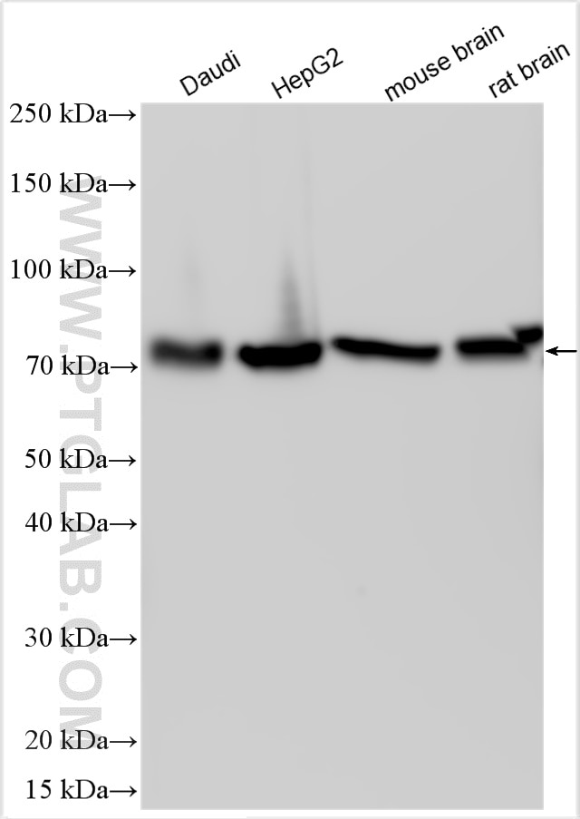 Western Blot (WB) analysis of various lysates using EGR2 Polyclonal antibody (13491-1-AP)