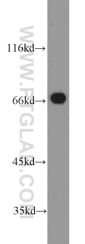 Western Blot (WB) analysis of mouse brain tissue using EGR2 Polyclonal antibody (13491-1-AP)
