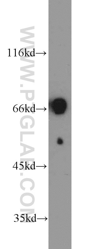 Western Blot (WB) analysis of mouse kidney tissue using EGR2 Polyclonal antibody (13491-1-AP)