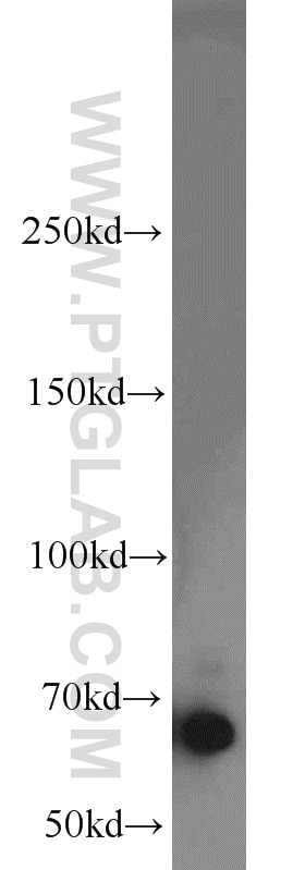 Western Blot (WB) analysis of MCF-7 cells using EGR2 Polyclonal antibody (13491-1-AP)