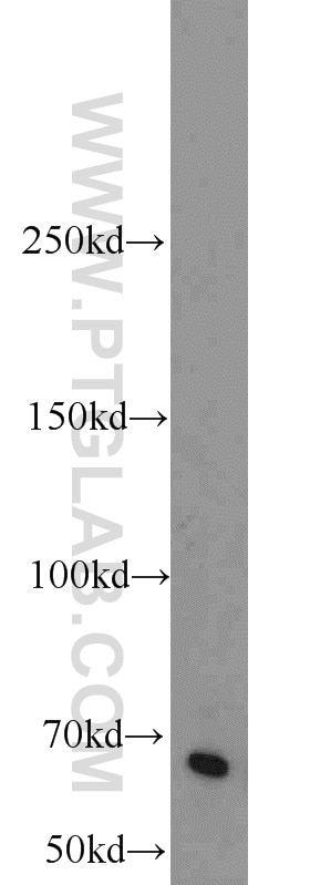 Western Blot (WB) analysis of PC-3 cells using EGR2 Polyclonal antibody (13491-1-AP)