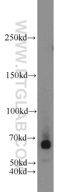 Western Blot (WB) analysis of SH-SY5Y cells using EGR2 Polyclonal antibody (13491-1-AP)