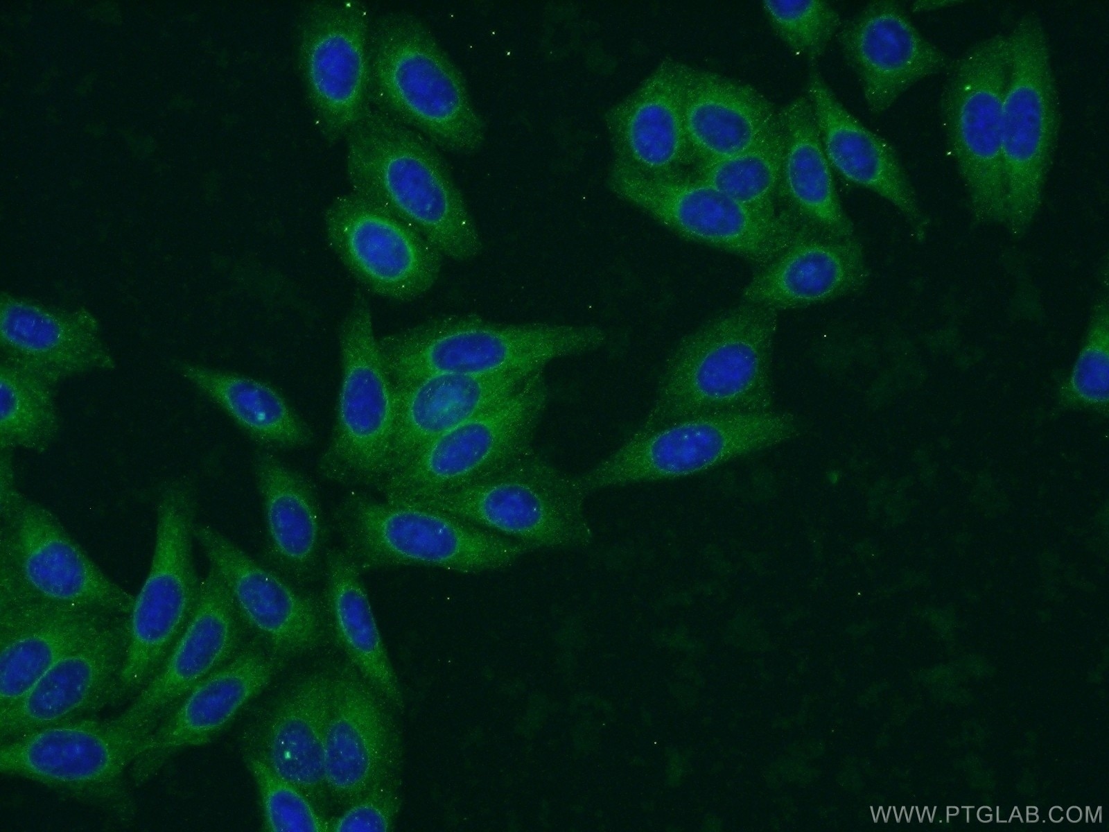 IF Staining of HepG2 using 17637-1-AP