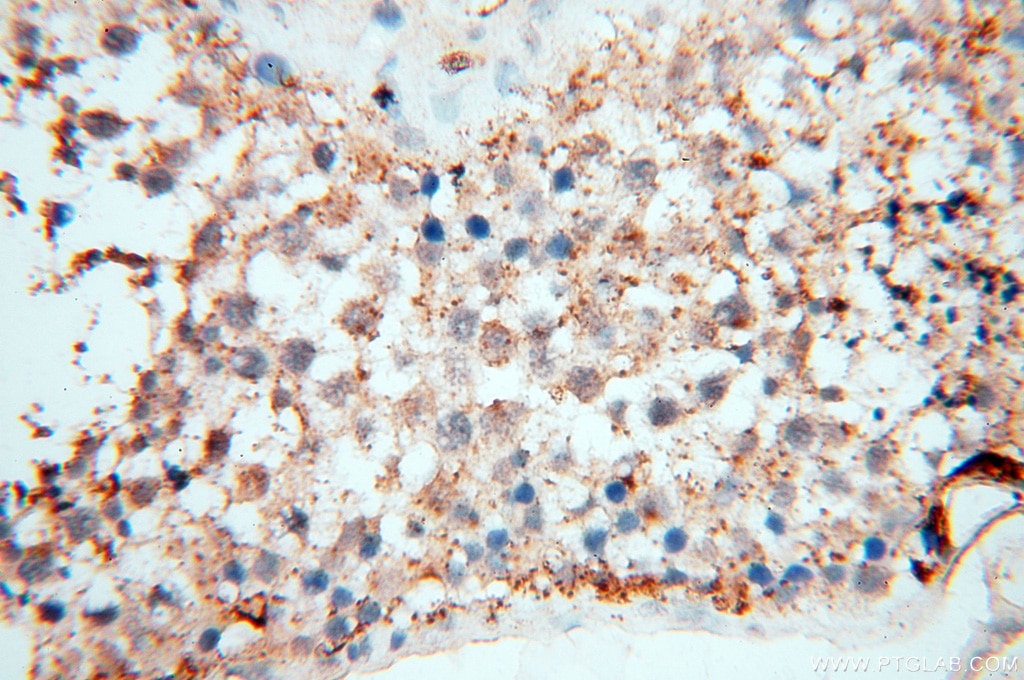 Immunohistochemistry (IHC) staining of human testis tissue using EHBP1 Polyclonal antibody (17637-1-AP)