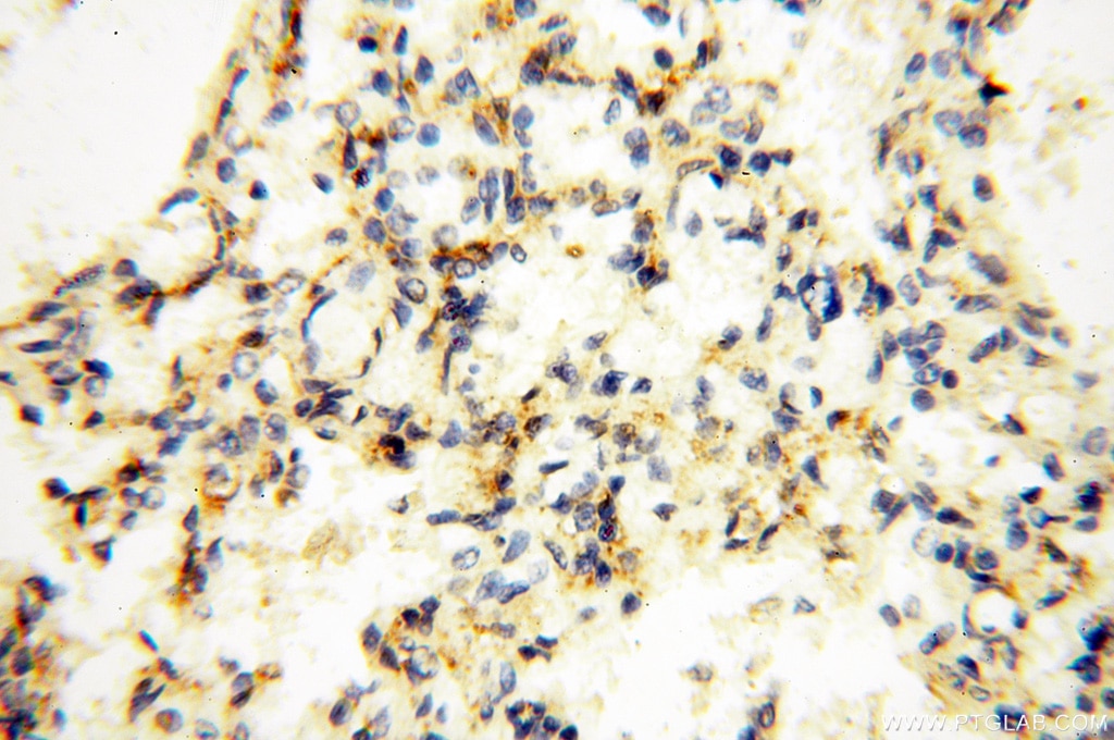 Immunohistochemistry (IHC) staining of human lung tissue using EHBP1 Polyclonal antibody (17637-1-AP)