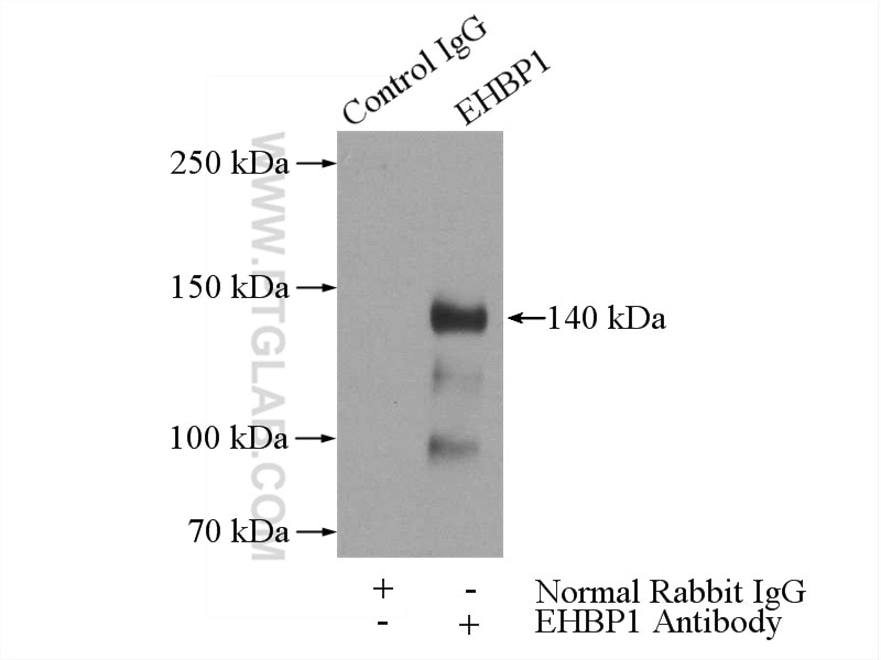 Immunoprecipitation (IP) experiment of mouse liver tissue using EHBP1 Polyclonal antibody (17637-1-AP)