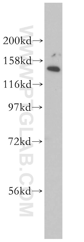 EHBP1 Polyclonal antibody