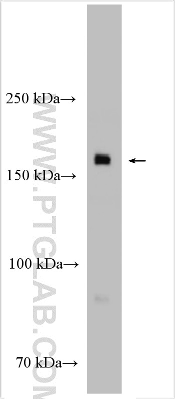 Western Blot (WB) analysis of rat testis tissue using EHBP1L1 Polyclonal antibody (29383-1-AP)