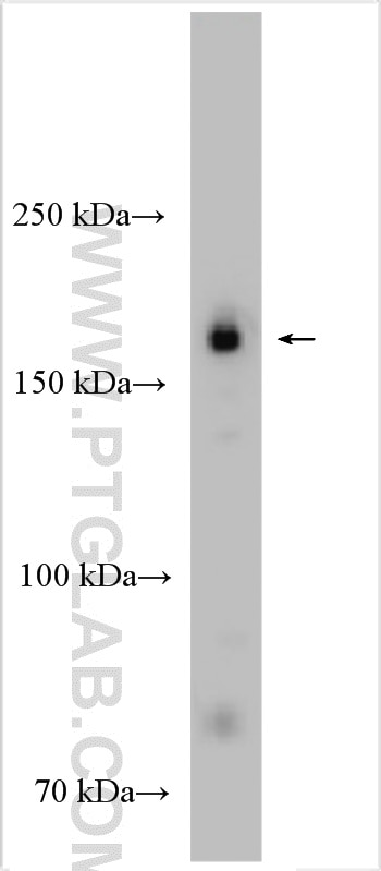 Western Blot (WB) analysis of mouse testis tissue using EHBP1L1 Polyclonal antibody (29383-1-AP)