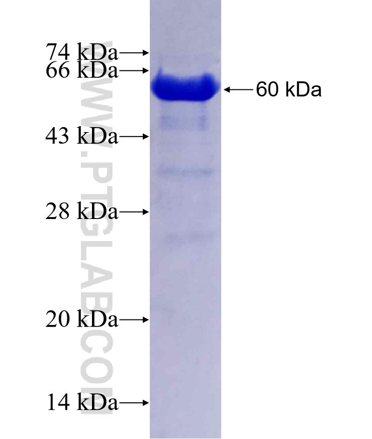 EHBP1L1 fusion protein Ag29796 SDS-PAGE