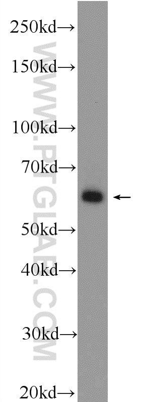 Western Blot (WB) analysis of mouse brain tissue using EHD1 Polyclonal antibody (24657-1-AP)