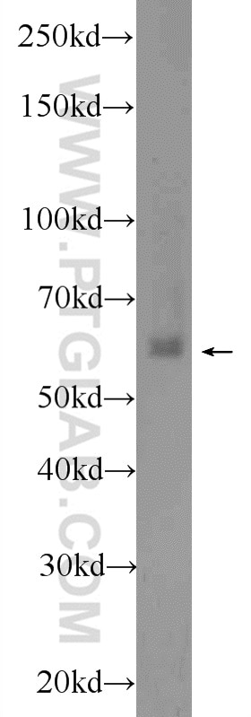 Western Blot (WB) analysis of HeLa cells using EHD1 Polyclonal antibody (24657-1-AP)